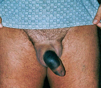 Fait vcu indit!